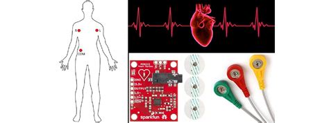 ECG Sensor MATLAB Code to Arduino Uno に対する画像結果