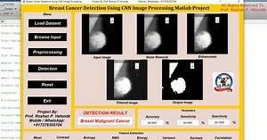 Breast Cancer Detection Using Image Processing Matlab Project With Source Code | Final Year Project Code