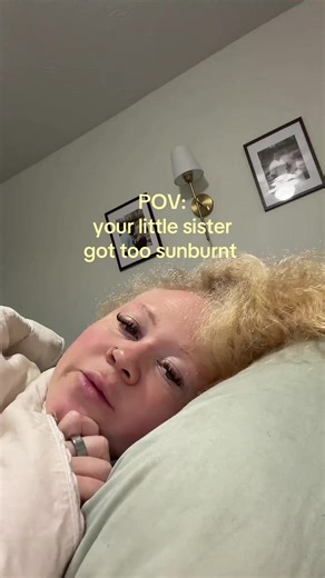 Handling Sunburn in Kids: Tips and Advice