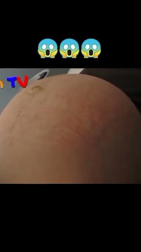 Baby moving like a alien inside mom's belly👽😱||
