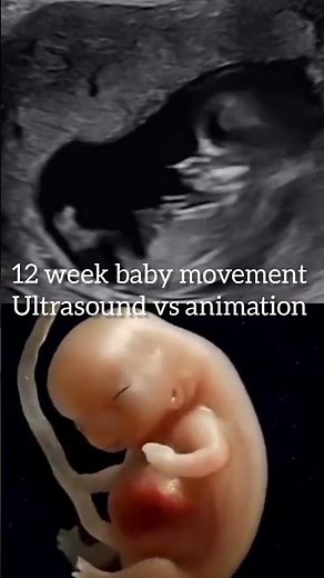 12 week baby movement ultrasound scan vs animation