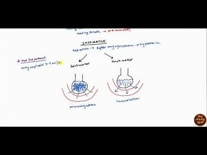 Drowning (Pathophysiology and Management) for USMLE
