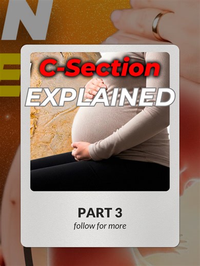 C-Sections Explained: Part 3 - Inside the Abdominal Cavity 👶✂️ Let's finally see what happens after cutting through the linea alba! Inside the Abdominal Cavity 🔬 After separating the rectus abdominis muscle heads, surgeons encounter the peritoneum (thin serous membrane)—they go through this too! What's Inside? 🫃 ✅ Greater omentum – Fatty apron-like tissue draping over intestines (but in full-term pregnancy, it's pushed out of the way!) ✅ Small intestine – Also pushed aside/behind the uterus d