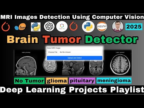Building a Brain Tumor Detection Using Deep Learning | MRI Images Detection Using Computer Vision