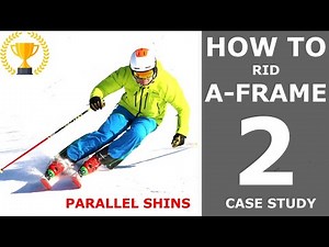 How to rid A-frame 2 - Case Study Peter